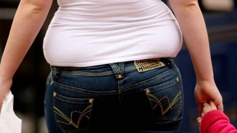 Nová metoda léčby obezity