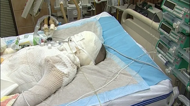 První dny po neštěstí