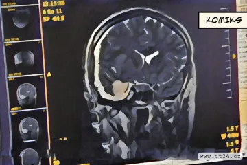 Na pomezí vědy a hororu. Vědci částečně oživili mozky prasat