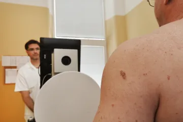 Zmrazení nádoru přispělo k uzdravení pacienta s melanomem. Podle lékařů jde o ojedinělý případ