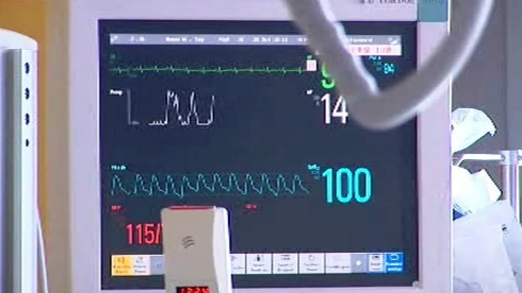 Monitor životních funkcí