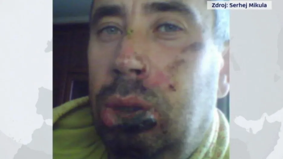 Snímek Mikuly po incidentu z minulého týdne