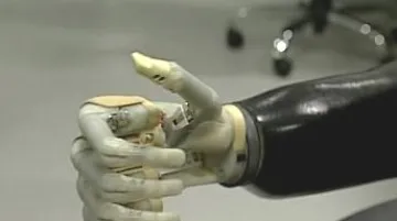 Bionická ruka