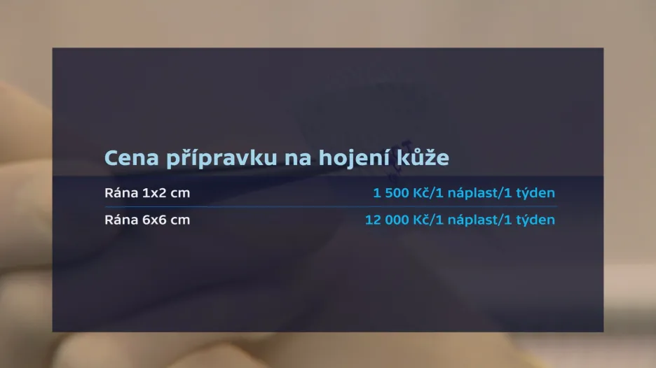 Infografika: Cena přípravku se liší podle velikosti rány