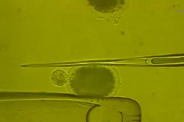 Kmenové buňky bude možné získat i z buněk lidské kůže