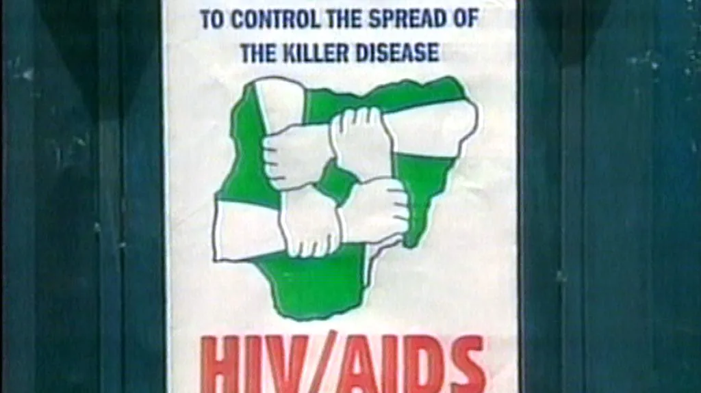 AIDS