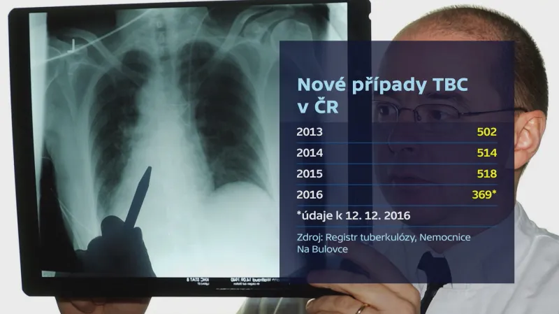 Výskyt tuberkulózy