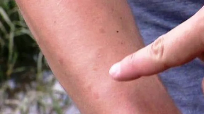 Moravu ohrožuje komáří kalamita
