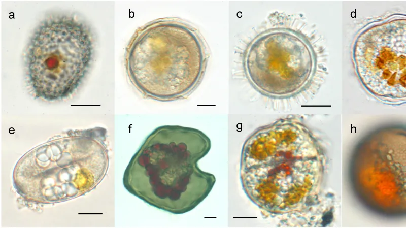 Různé druhy obrněnek pod mikroskopem