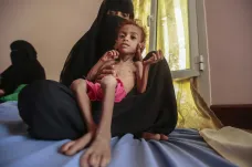 Zpráva z jemenských nemocnic: „Nikdo nepláče, ani se nesměje, je tam mrtvé ticho“