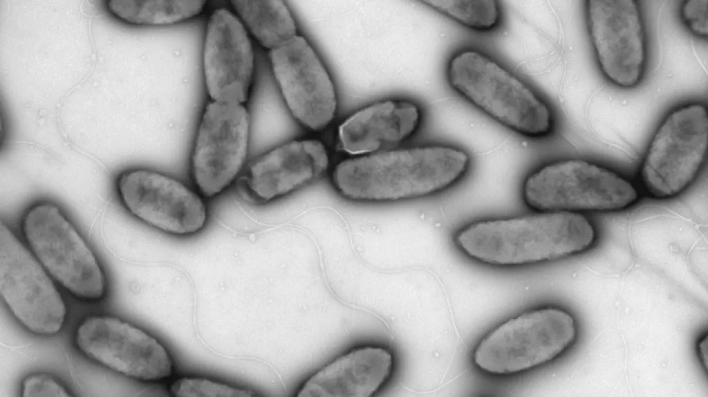 Nová bakterie má tyčinkový tvar a bičíky