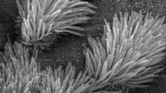 Řasinky pod elektronovým mikroskopem