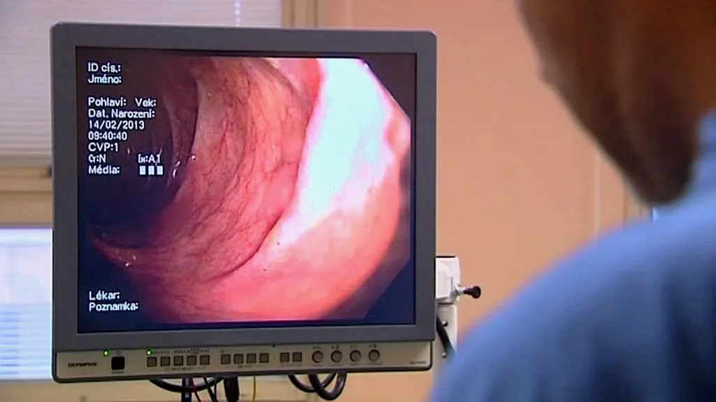 Vyšetření střeva