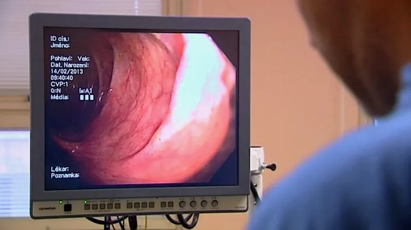 Vyšetření střeva