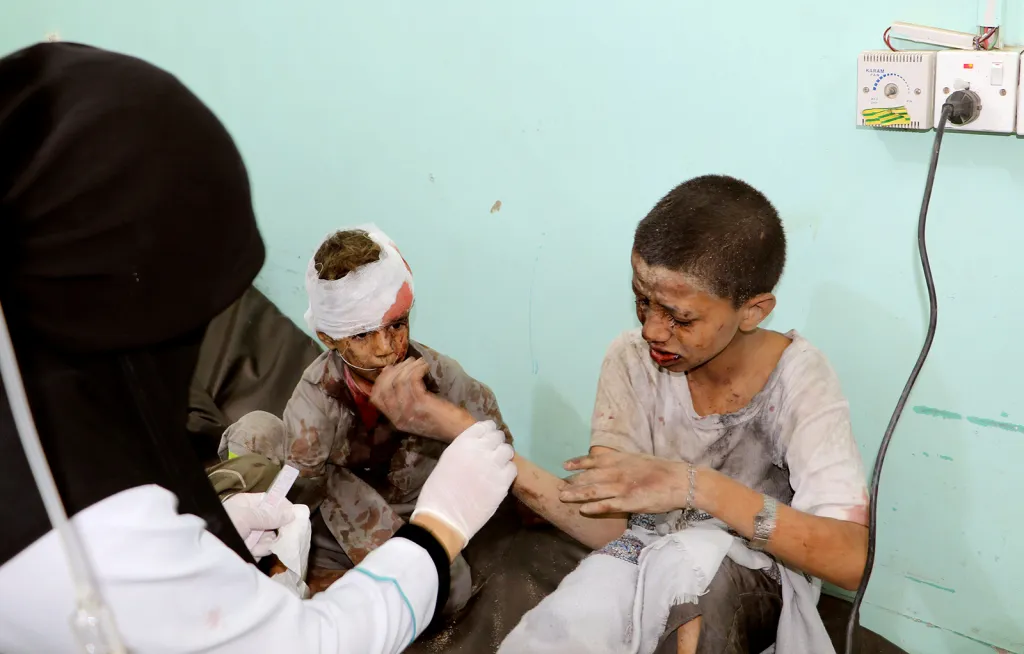 Lékařská kontrola dětí zasažených leteckým úderem na jemenské město Saada