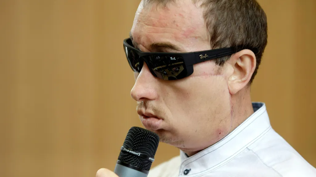 Polák Grzegorz po transplantaci obličeje