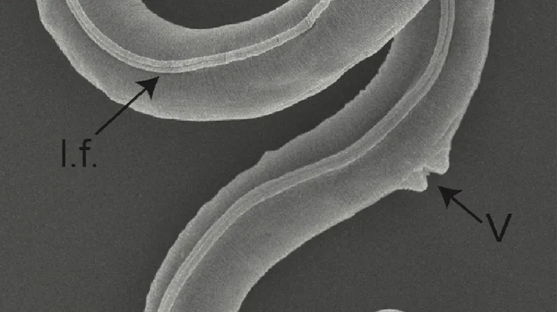 Panagrolaimus kolymaensis