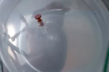 Španělští vědci vyvinuli umělou dělohu. Zatím má rekord 12 dní