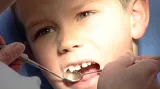 Zubní prohlídka
