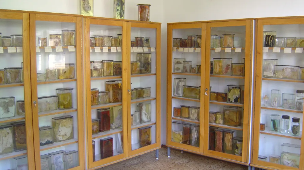 Muzeum patologie v Opavě