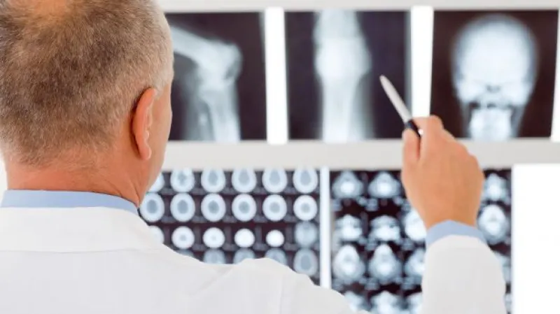 Senátoři si u Ústavního soudu stěžují na úhradovou vyhlášku