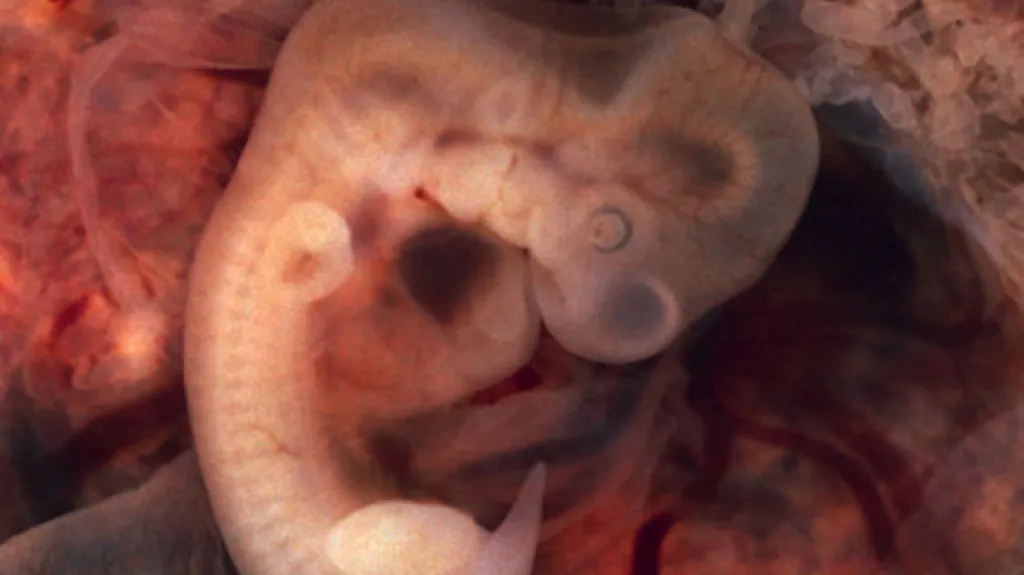 Lidské embryo