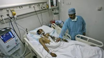 Zraněný jemenský demonstrant