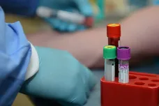 Blíží se koronavirové testy ze slin a mohou být přelomem. Jsou bezbolestné a rychlé