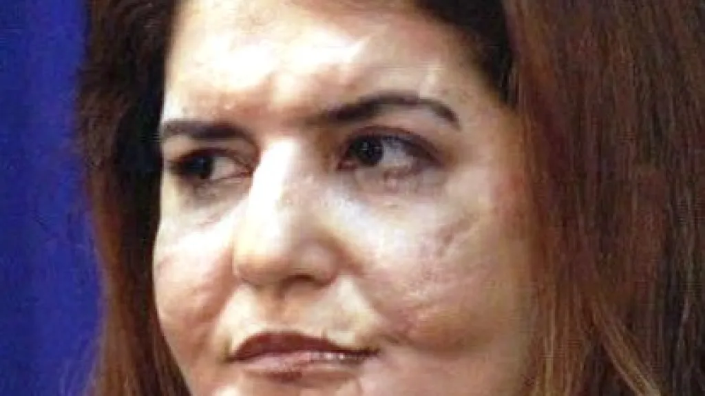 Aylin Korkmazová