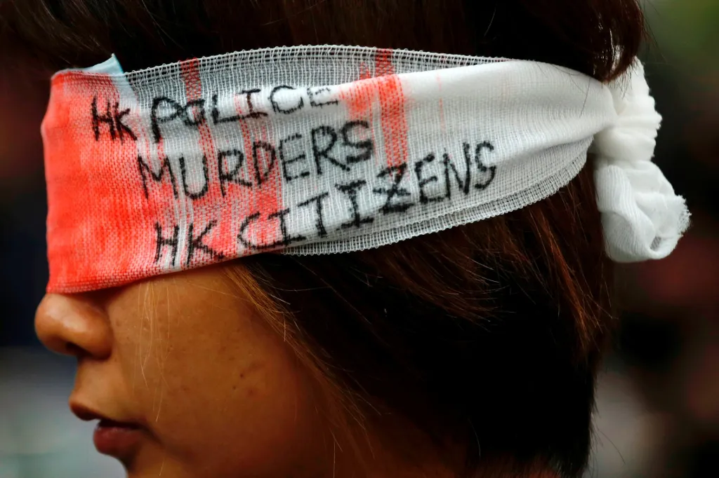 Při protestech v Hongkongu zasáhl mladou medičku do oka policejní projektil. Vlivem této události si stovky protestujících začaly zakrývat jedno oko jako gesto připomínající tvrdost policejního zákroku