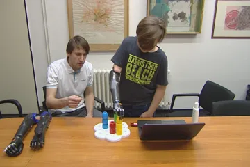 Moderní bionické protézy výrazně ulehčí pacientům život. Ne každý na ně má ale nárok