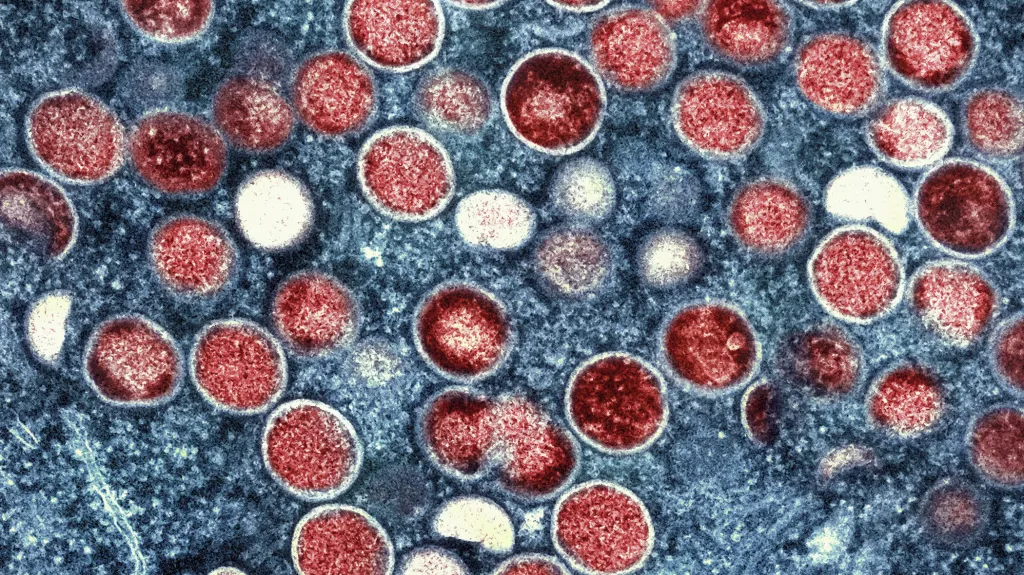 Virus mpox