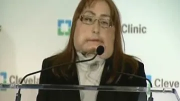 Žena s transplantovanou tváří