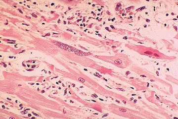 Vědci si chtějí „ochočit“ toxoplasmu. Mohla by léčit nemoci mozku