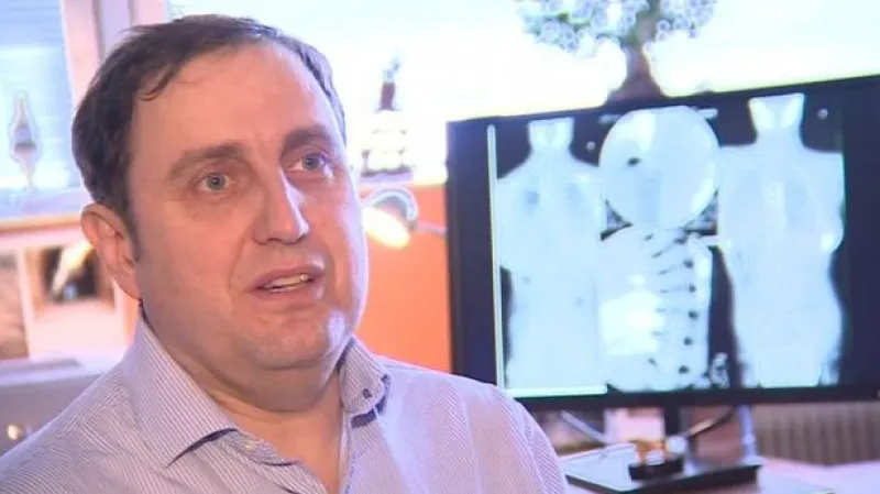 Martin Repko o nutnosti, založit web pro pacienty se skoliózou