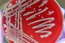 Mladá studentka přišla s nano-zbraní proti bakteriím, které odolávají antibiotikům