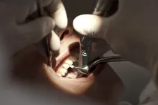 Konec utrpení u zubaře? Britové našli gen, který opravuje zuby