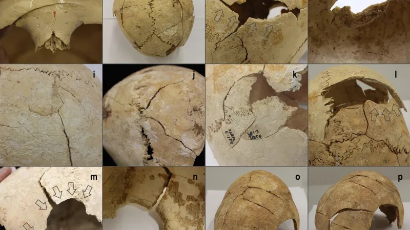 Lebky poškozené zraněními z války
