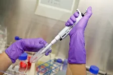 Plíce poškozené koronavirem mohou zregenerovat kmenové buňky. Brněnské centrum nabídlo přípravek státu