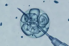SÚKL: Záměnu embryí při umělém oplodnění způsobila chyba jednotlivce
