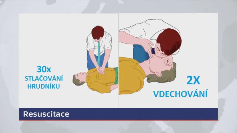 Postup při resuscitaci