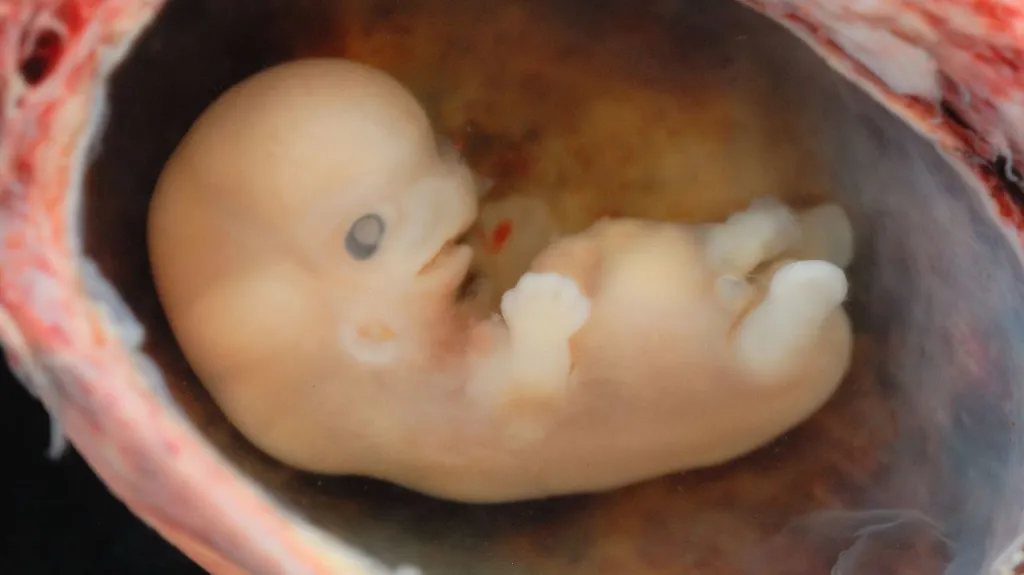 Osmitýdenní lidské embryo
