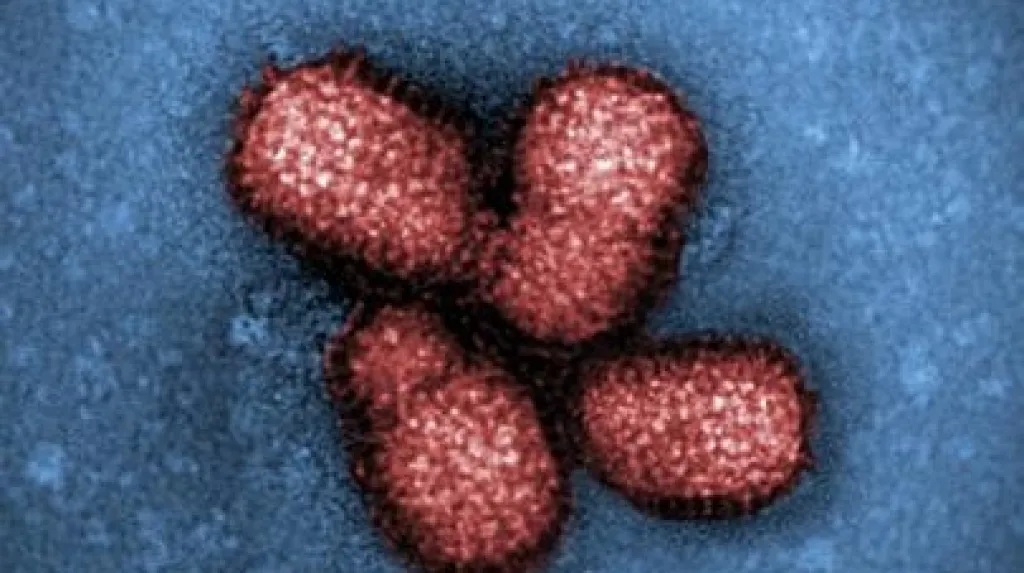 Virus chřipky typu H1N1
