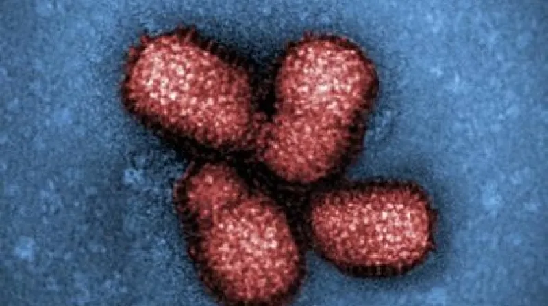 Virus chřipky typu H1N1