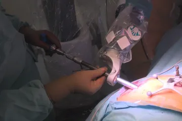 V Ústí nad Labem provedli první robotickou biopsii mozku v Česku