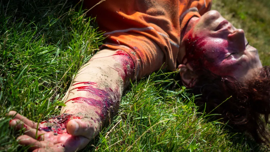 Zachraň život! - Úraz