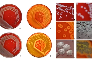 Geneticky upravené bakterie fungují jako beranidlo na odolnost proti antibiotikům
