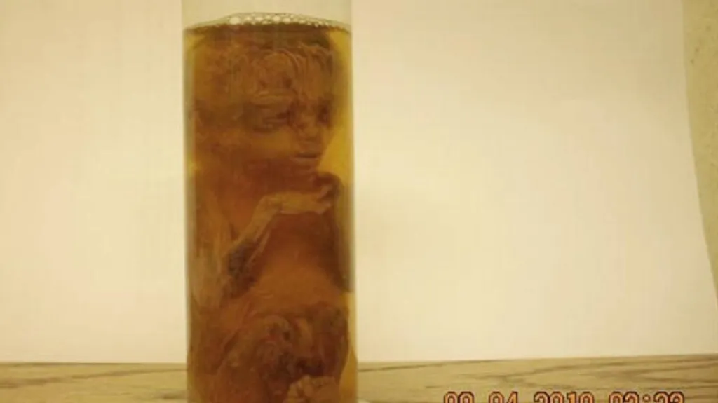 Muž našel na lavičce lidský plod