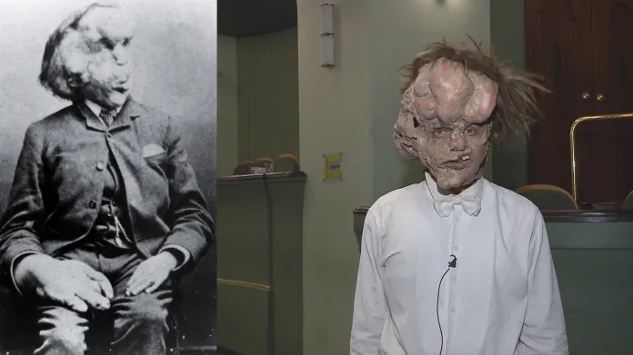 Vlevo historická fotografie Josepha Merricka, vpravo herec Tomáš Havlínek s maskou