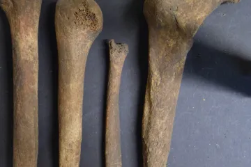 Kosti jako nástroje, mozek odebraný z hlavy. Skotští archeologové luští hádanku
